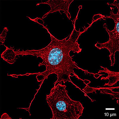 96 Well Plate Round | Microplate for Fluorescence Microscopy | ibidi