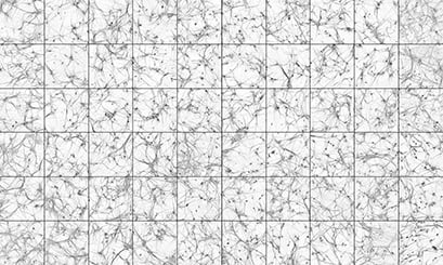 Human induced pluripotent stem cell (hiPSC) derived neurons stained with MAP2