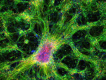 Immunofluorescence image of dopaminergic neurons derived from human induced pluripotent stem cells (iPSCs) in an ibidi μ-Plate 96 Well