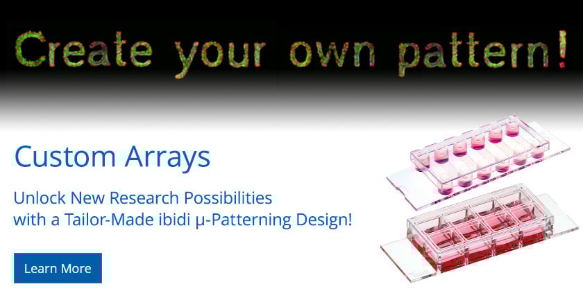 Customized ibidi µ-Pattern on Special Request