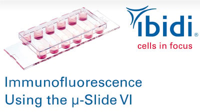 MV 18: Immunofluorescence Using the µ-Slide VI
